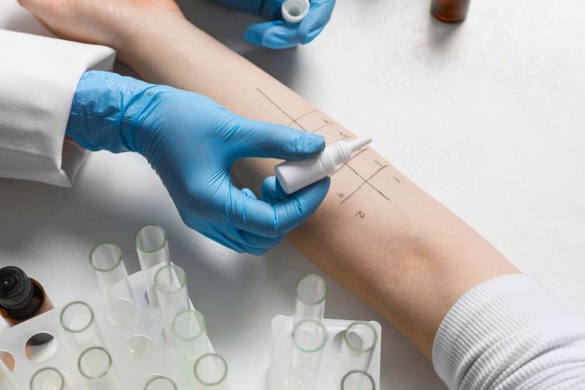 Su pavasariniais žiedais sugrįžta ir alergijos: papasakojo, kaip pasiruošti alergijų sezonui, ir atskleidė, kodėl visi yra kažkam alergiški